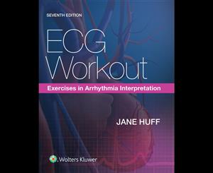 ECG Workout  Exercises in Arrhythmia Interpretation