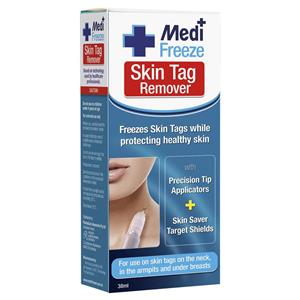 Medi Freeze Skin Tag Remover