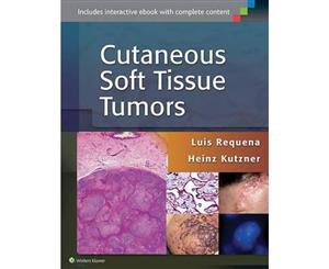 Cutaneous Soft Tissue Tumors