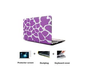 Catzon Laptop Case+DustPlug+Keyboard Cover+Screen Protector Cover Hard Case For Macbook11 12 13 15 inchesClassic02