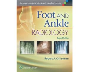 Foot and Ankle Radiology