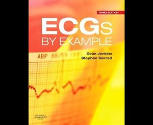 ECGs by Example 3e